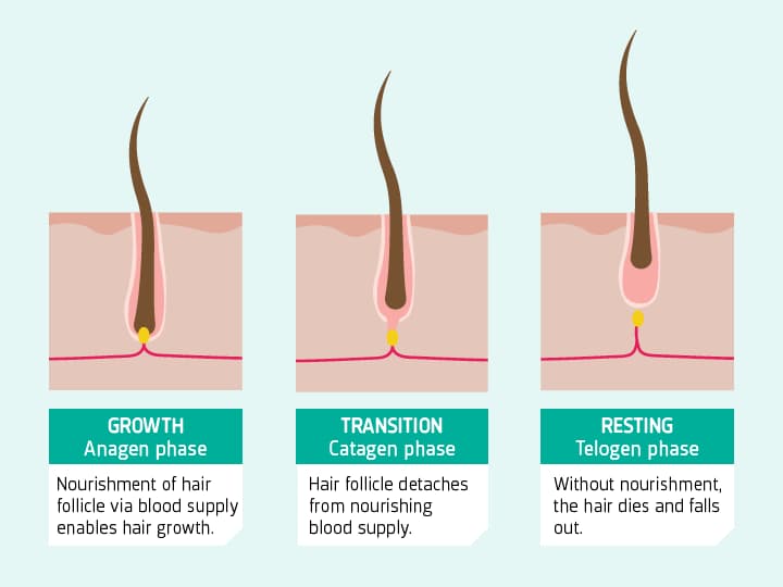 If untreated, a higher number of hair follicles prematurely enter the resting (telogen) phase, 